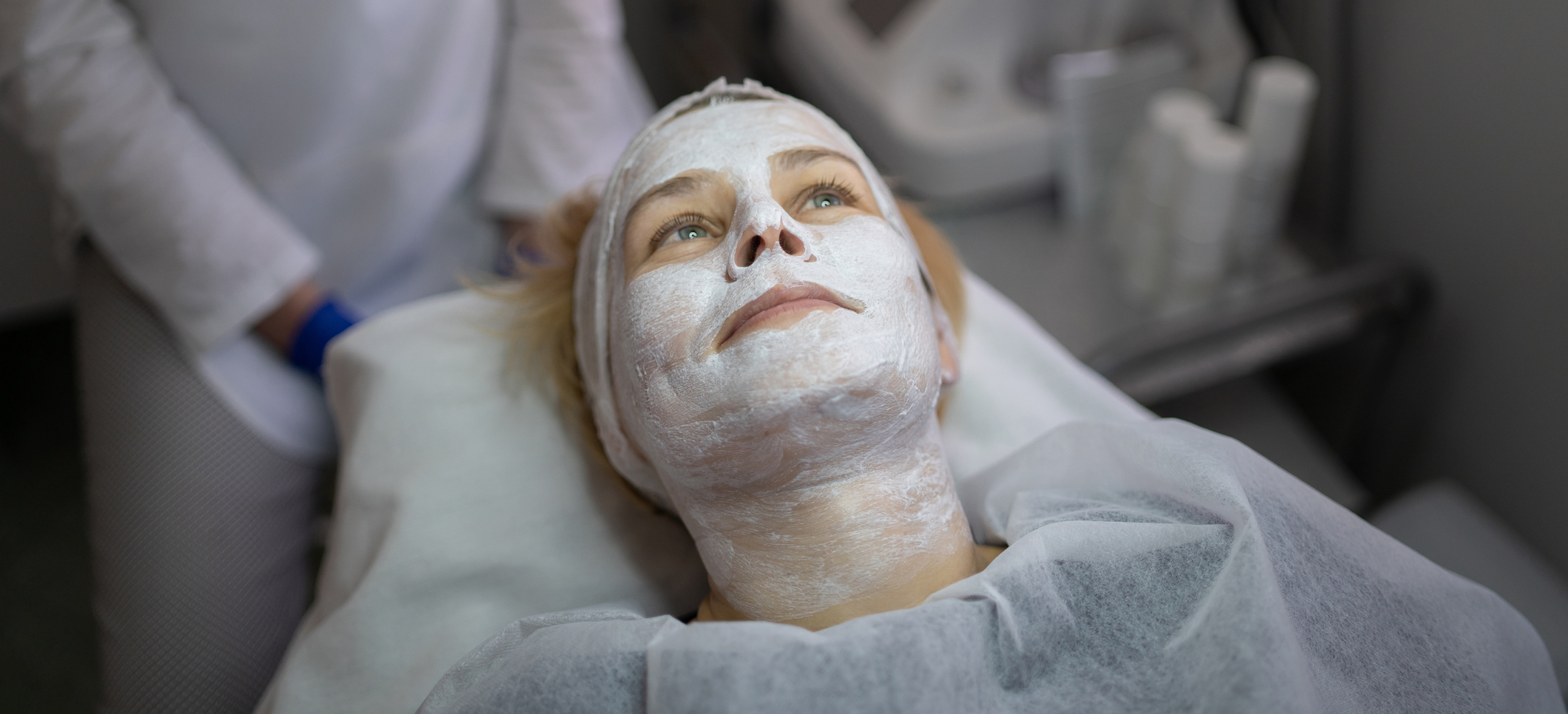 Mélasma : comprendre et prévenir l’hyperpigmentation